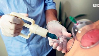 Hacamatın Faydaları: Kan Dolaşımını Artırma, Ağrıları Azaltma ve Daha Fazlası!