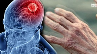 Parkinson Hastalığı: Belirtiler, Nedenler ve Tedavi Yöntemleri