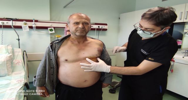 Ksü'de Kalp Ve Damar Cerrahisinde İlk Oldu