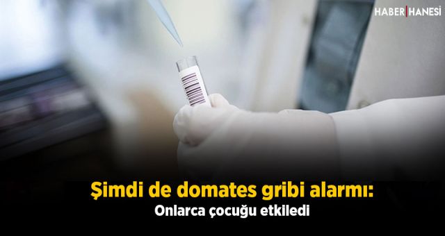 Şimdi de domates gribi alarmı: Onlarca çocuğu etkiledi