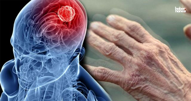 Parkinson Hastalığı: Belirtiler, Nedenler ve Tedavi Yöntemleri