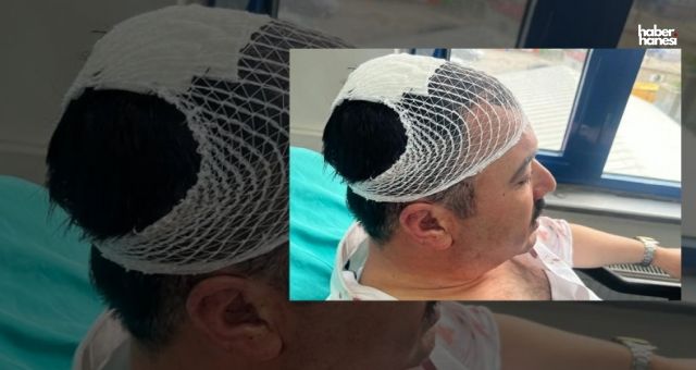 Kahramanmaraş’ta Saldırı Şoku: Başkan Yardımcısı Hastaneye Kaldırıldı